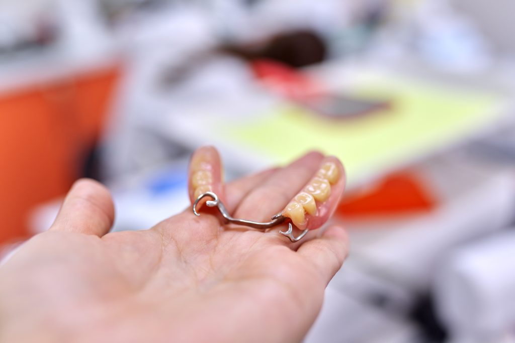 Clasp Adaptation – Without Sending The Partial Denture To The Lab